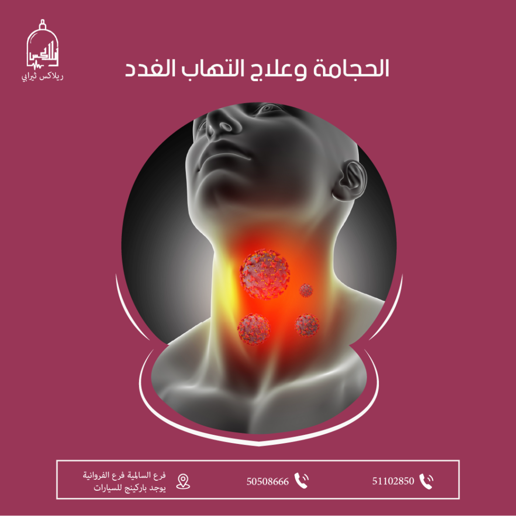 الحجامة وعلاج التهاب الغدد 50508666