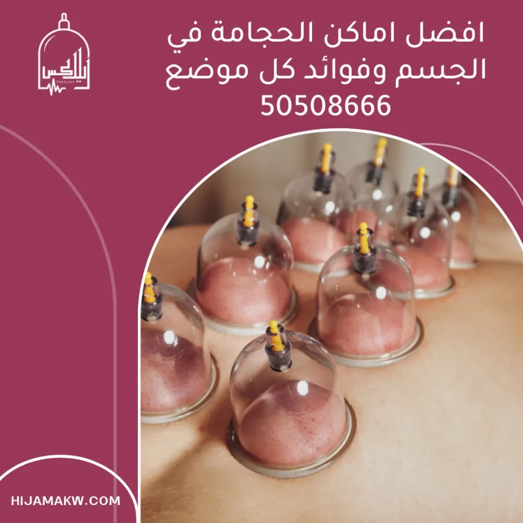 افضل اماكن الحجامة في الجسم