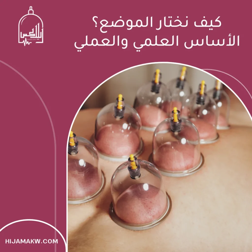 افضل اماكن الحجامة في الجسم
