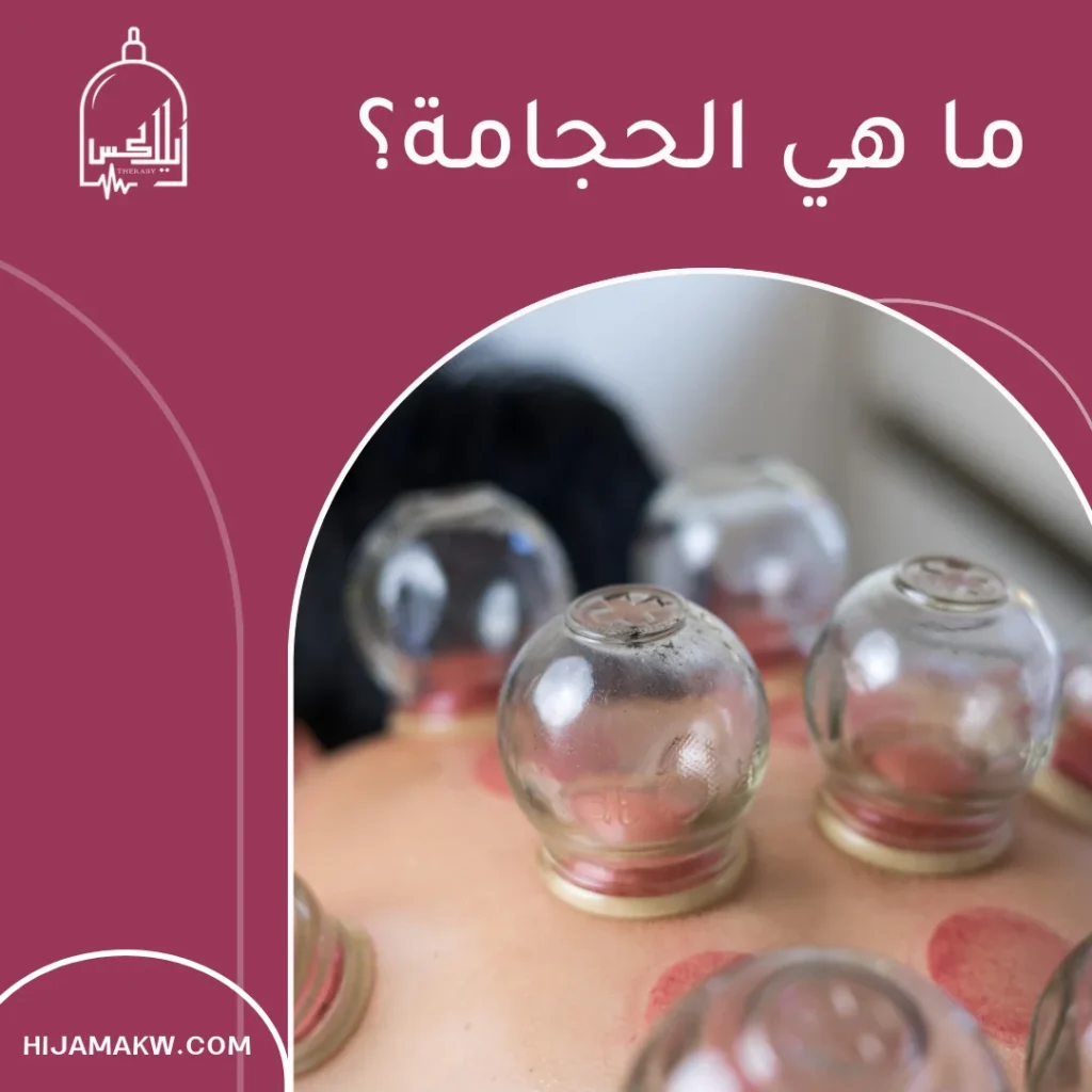 الحجامة