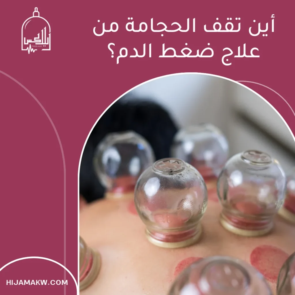 الحجامة وضغط الدم المرتفع