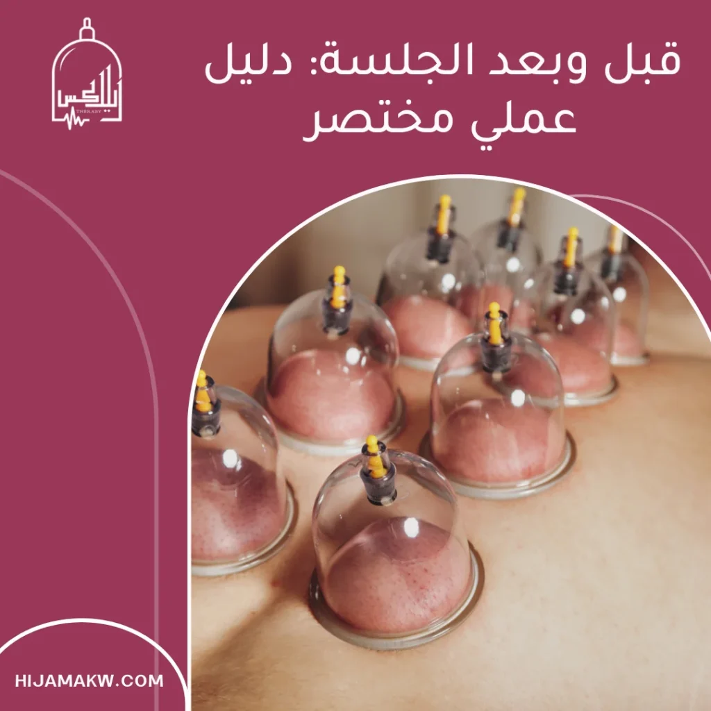 افضل اماكن الحجامة في الجسم
