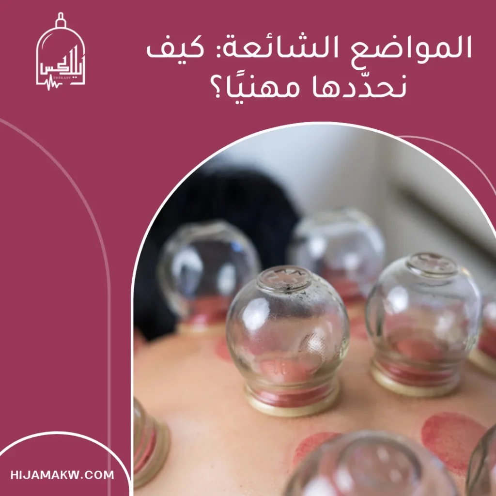 الحجامة