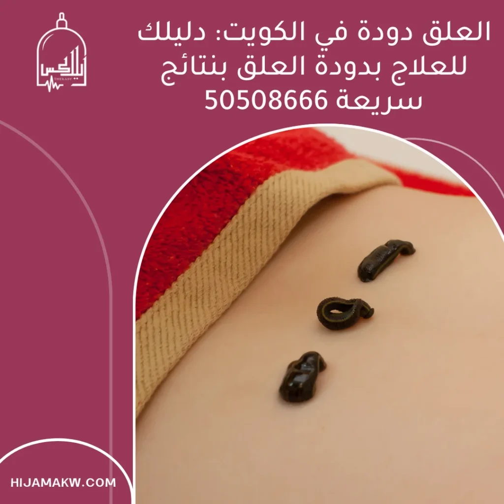 العلق دودة