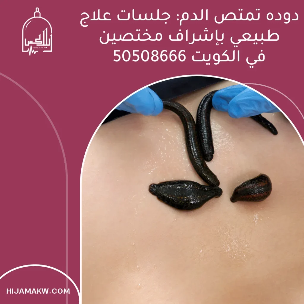 دوده تمتص الدم
