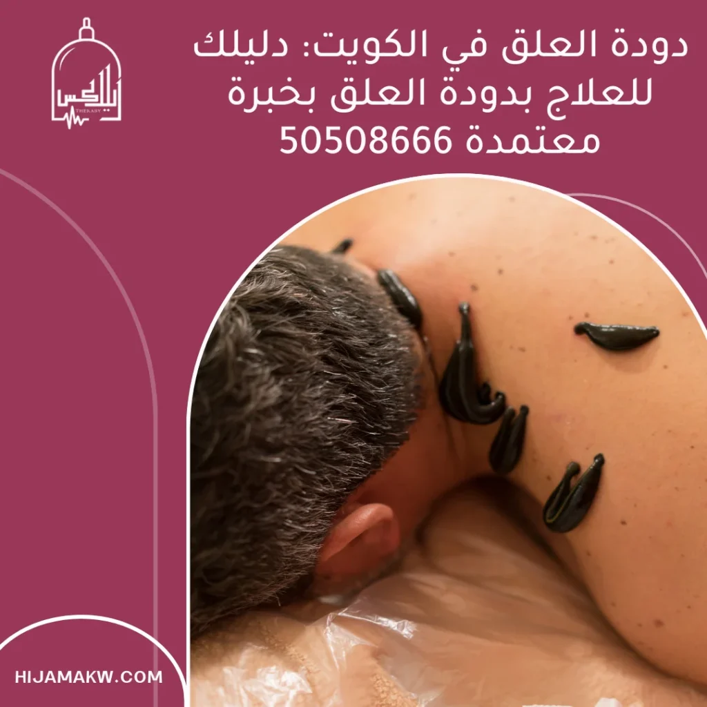 دودة العلق