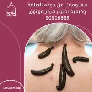 معلومات عن دودة العلقة