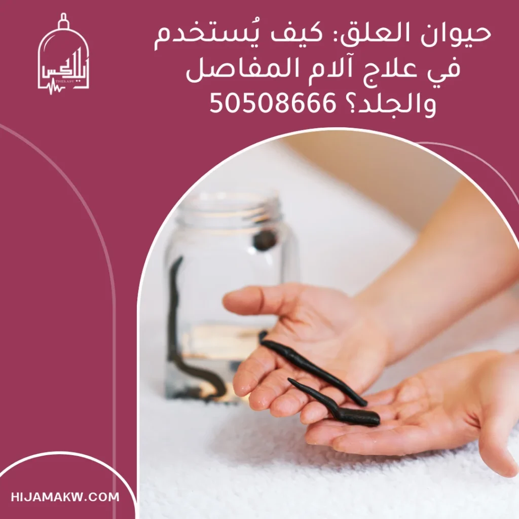 حيوان العلق