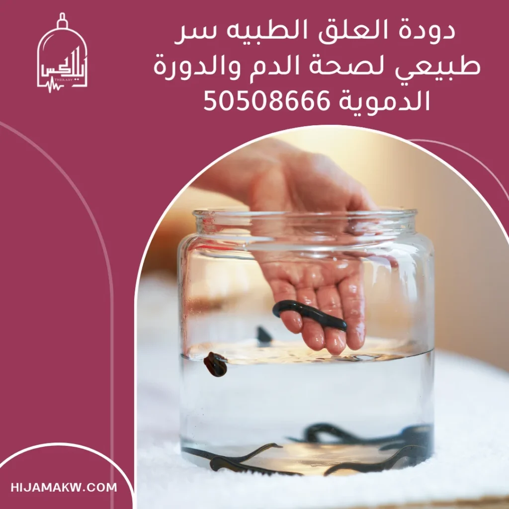 دودة العلق الطبيه