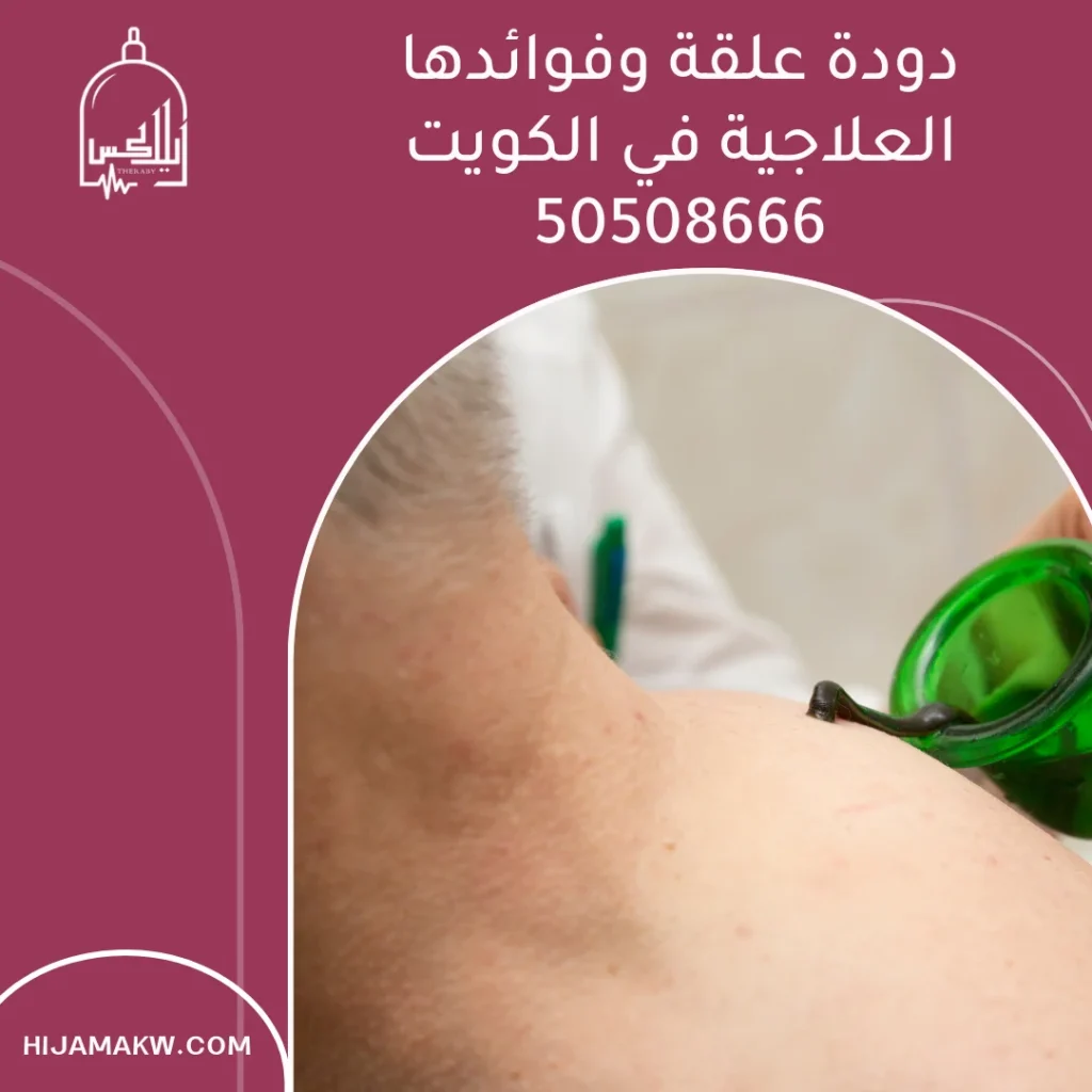 دودة علقة