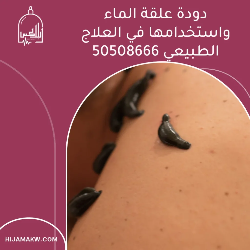 دودة علقة الماء