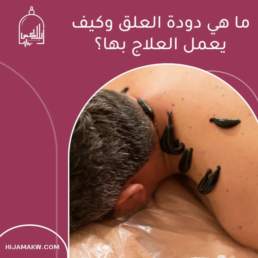 دودة العلق