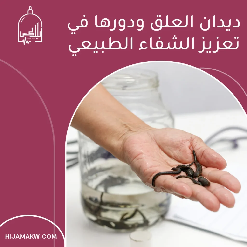 ديدان العلق