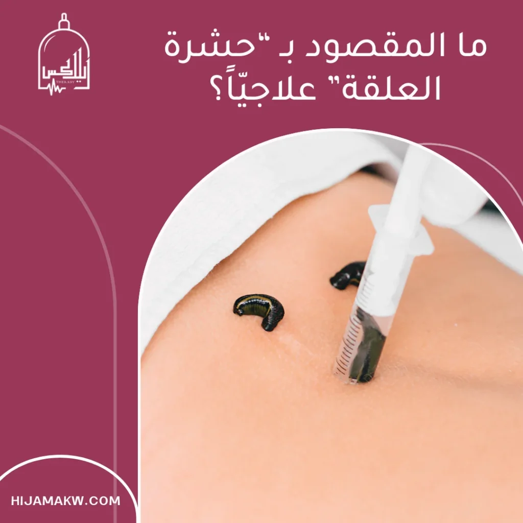 حشرة العلقة