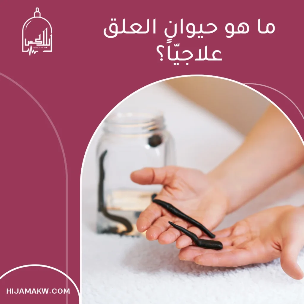 حيوان العلق
