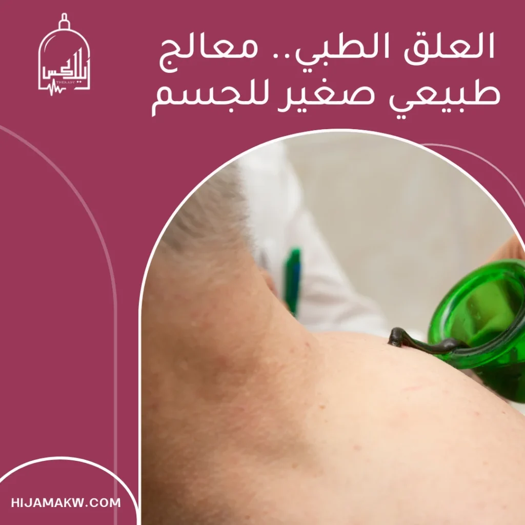 دودة علقة