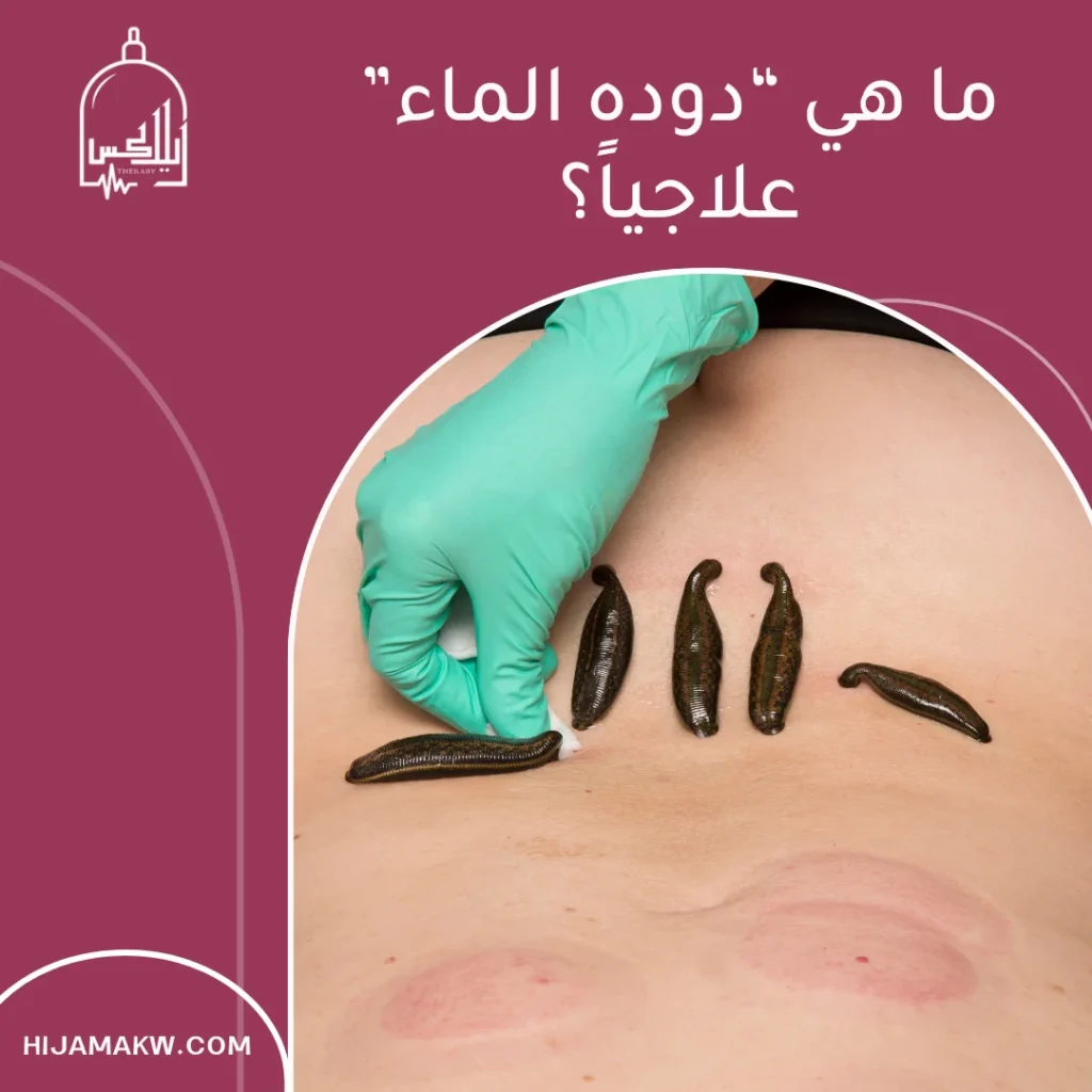 دوده الماء