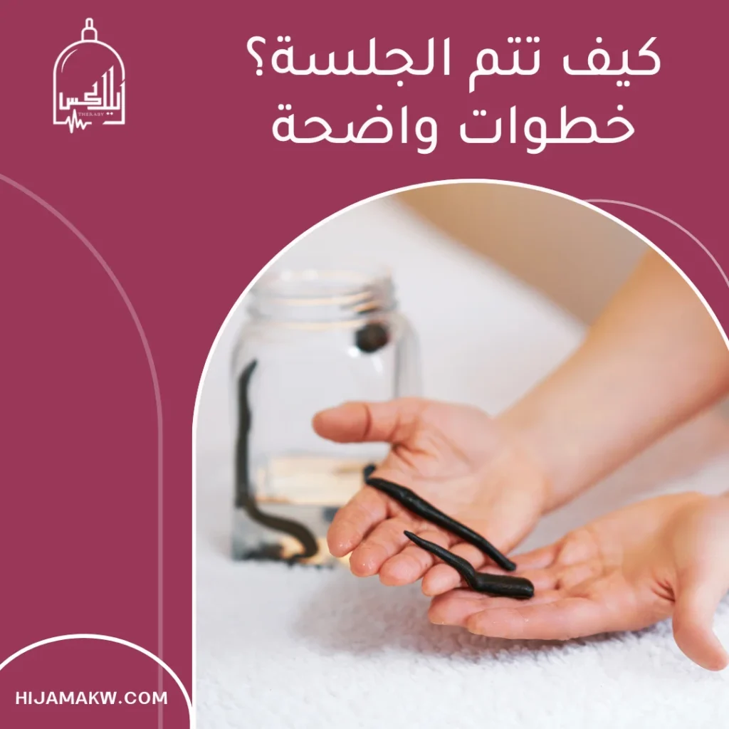حيوان العلق