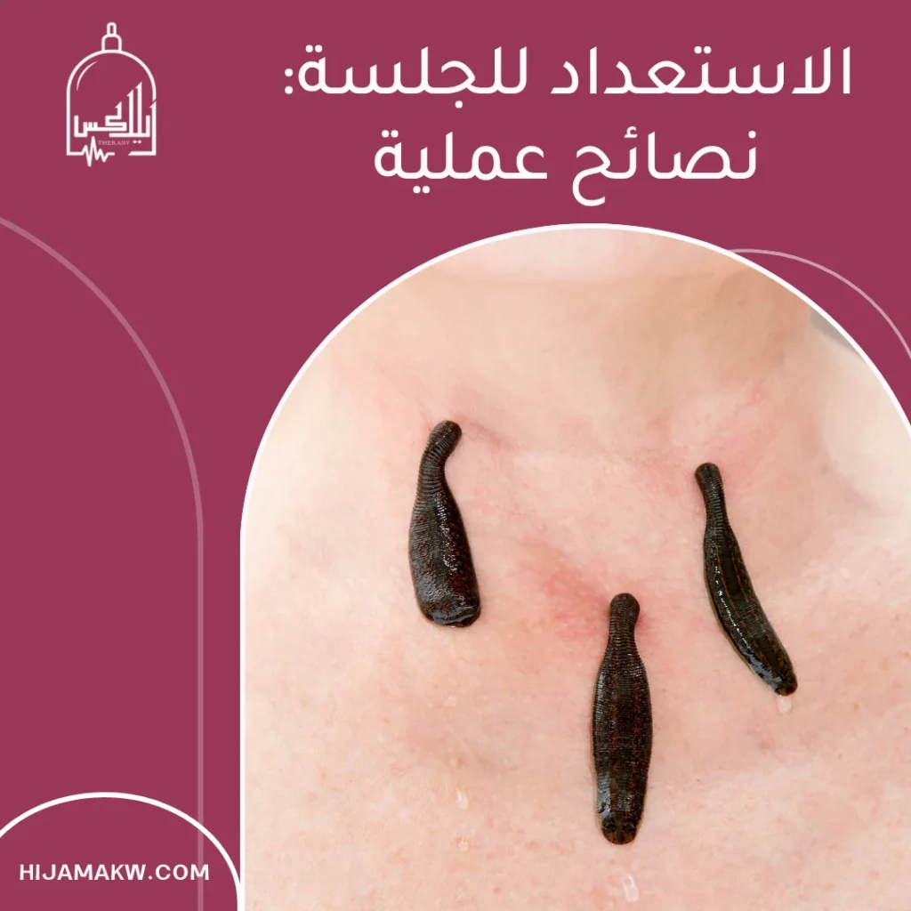 دودة العلق الطبى