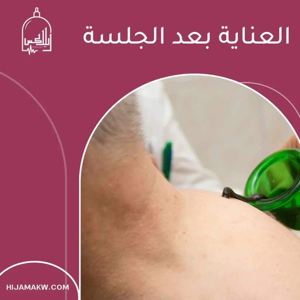 دودة علقة