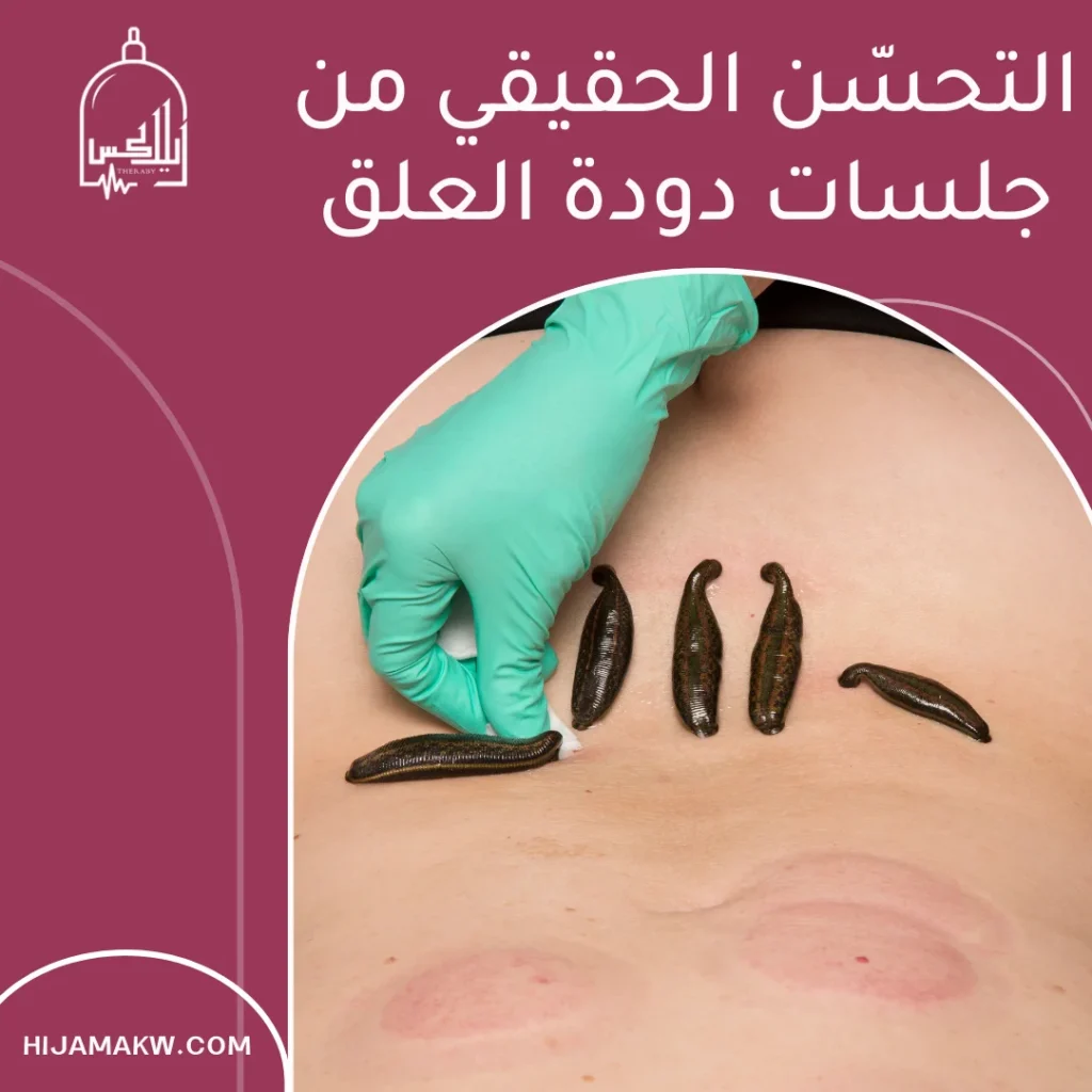 دوده الماء