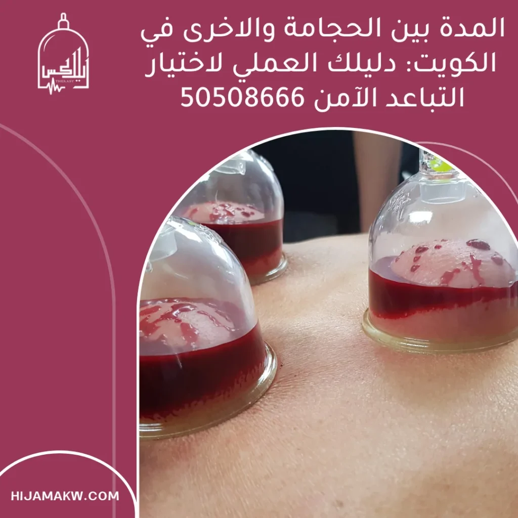 المدة بين الحجامة والاخرى في الكويت: دليلك العملي لاختيار التباعد الآمن 50508666 المدة بين الحجامة والاخرى