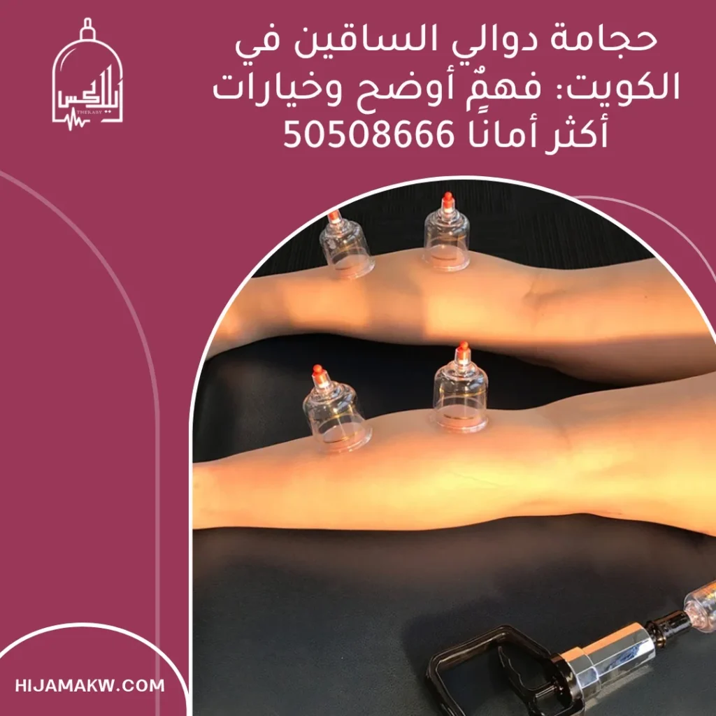 حجامة دوالي الساقين في الكويت: فهمٌ أوضح وخيارات أكثر أمانًا 50508666 حجامة دوالي الساقين
