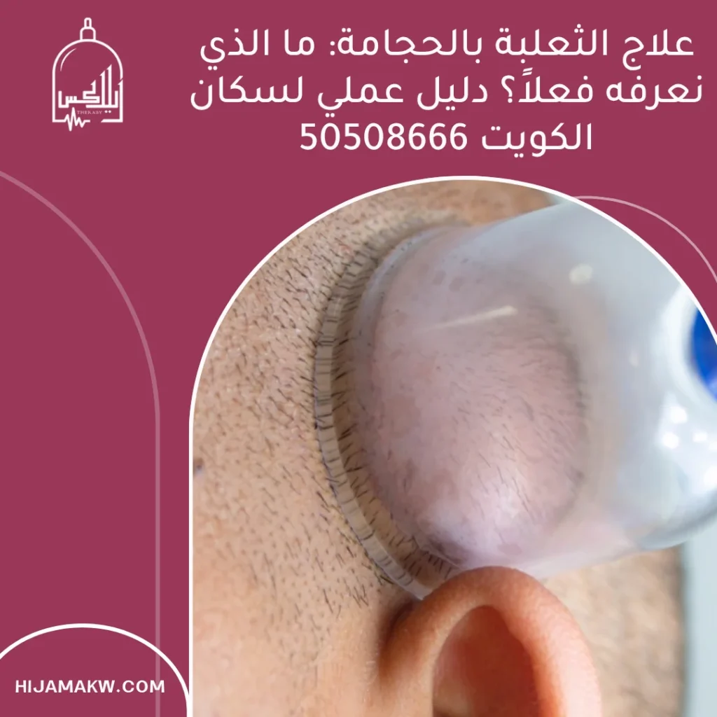 علاج الثعلبة بالحجامة: ما الذي نعرفه فعلاً؟ دليل عملي لسكان الكويت 50508666 علاج الثعلبة بالحجامة