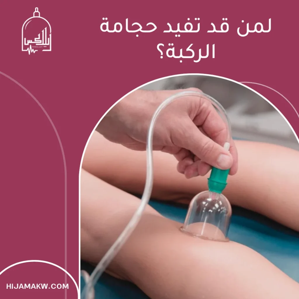 حجامة الركبة في الكويت: دليل عملي لتخفيف تيبّس وألم المفصل 50508666 حجامة الركبة