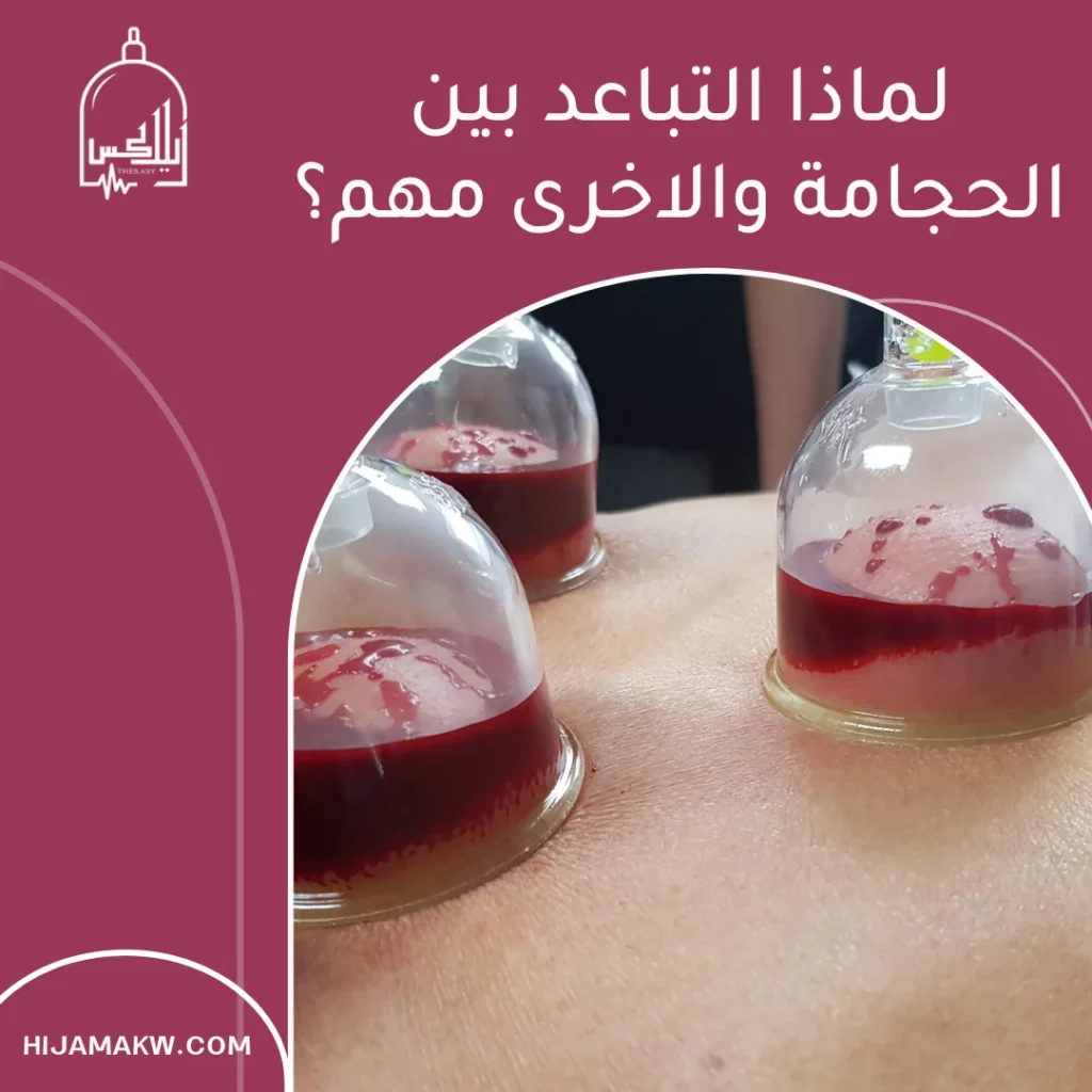 المدة بين الحجامة والاخرى في الكويت: دليلك العملي لاختيار التباعد الآمن 50508666 المدة بين الحجامة والاخرى