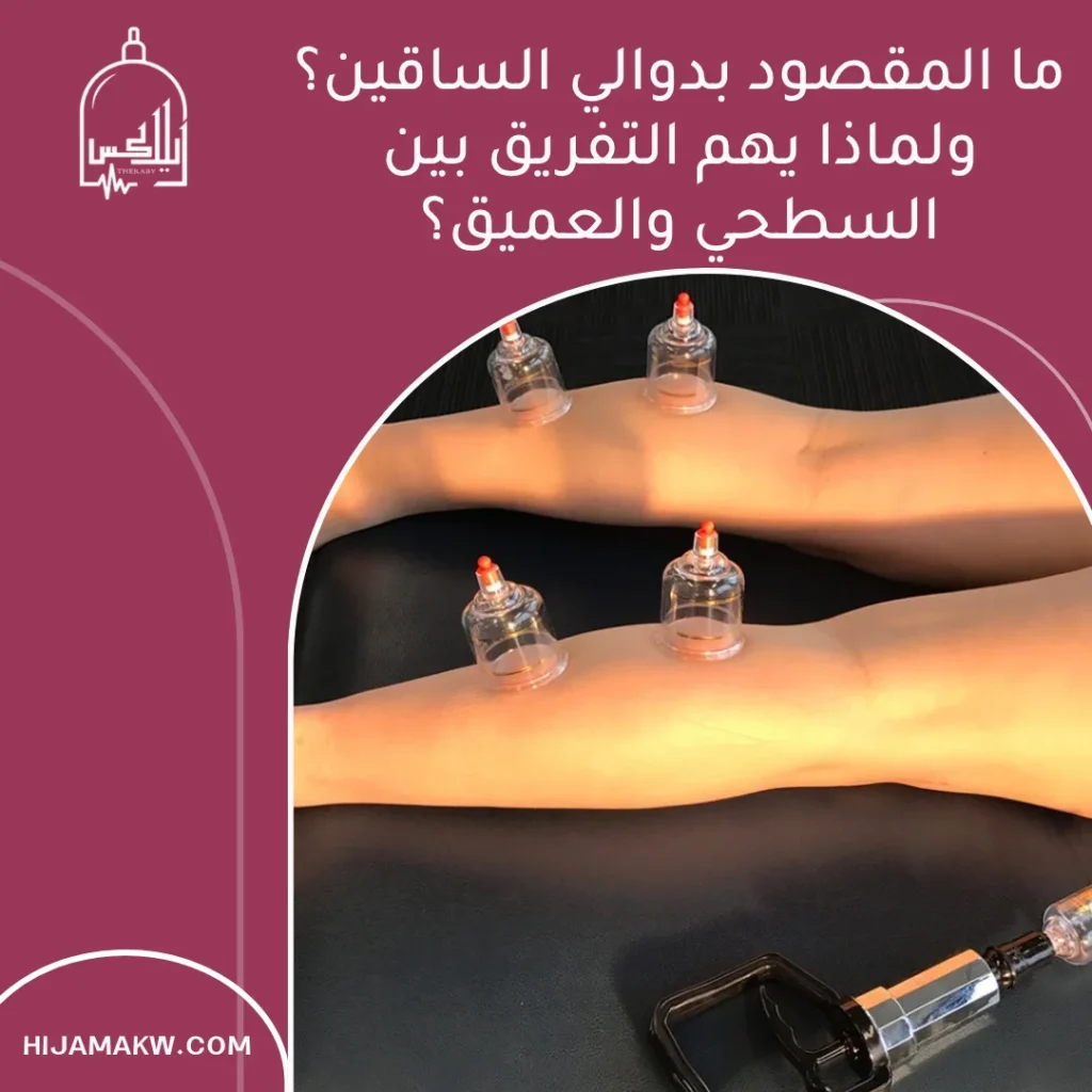 حجامة دوالي الساقين في الكويت: فهمٌ أوضح وخيارات أكثر أمانًا 50508666 حجامة دوالي الساقين