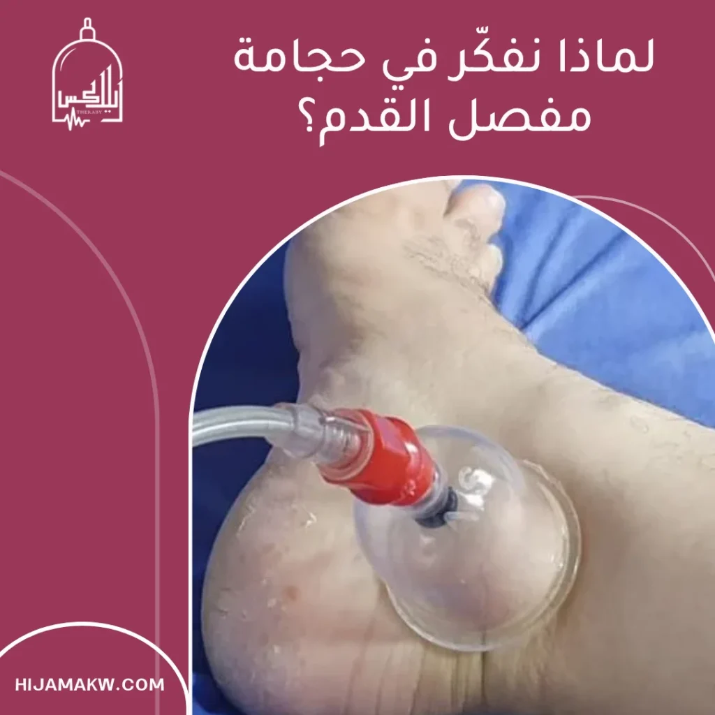 حجامة مفصل القدم في الكويت: دليل عملي لتخفيف الشدّ واستعادة الحركة 50508666 حجامة مفصل القدم