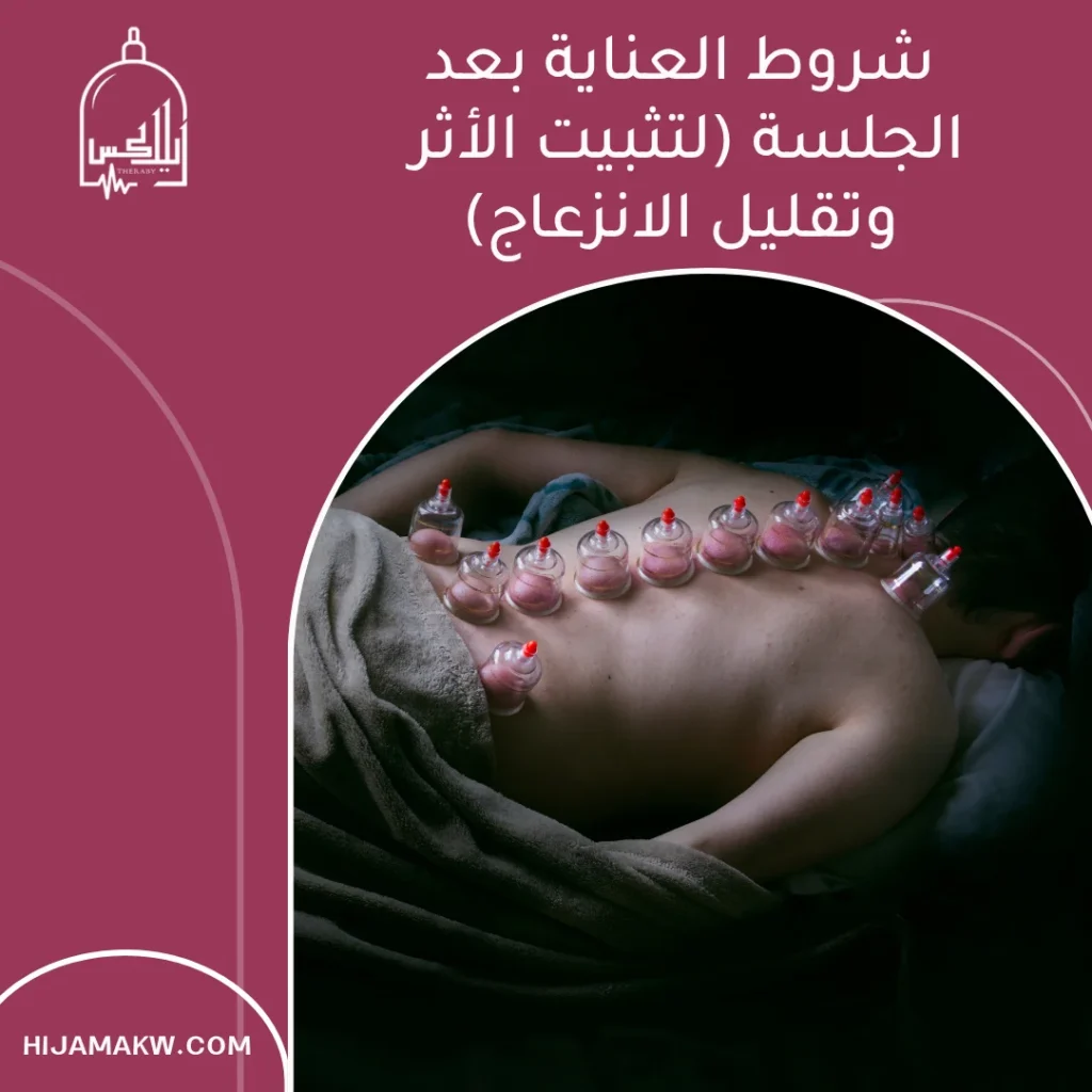 شروط عمل الحجامة في الكويت: الدليل العملي للأمان والجودة 50508666 شروط عمل الحجامة