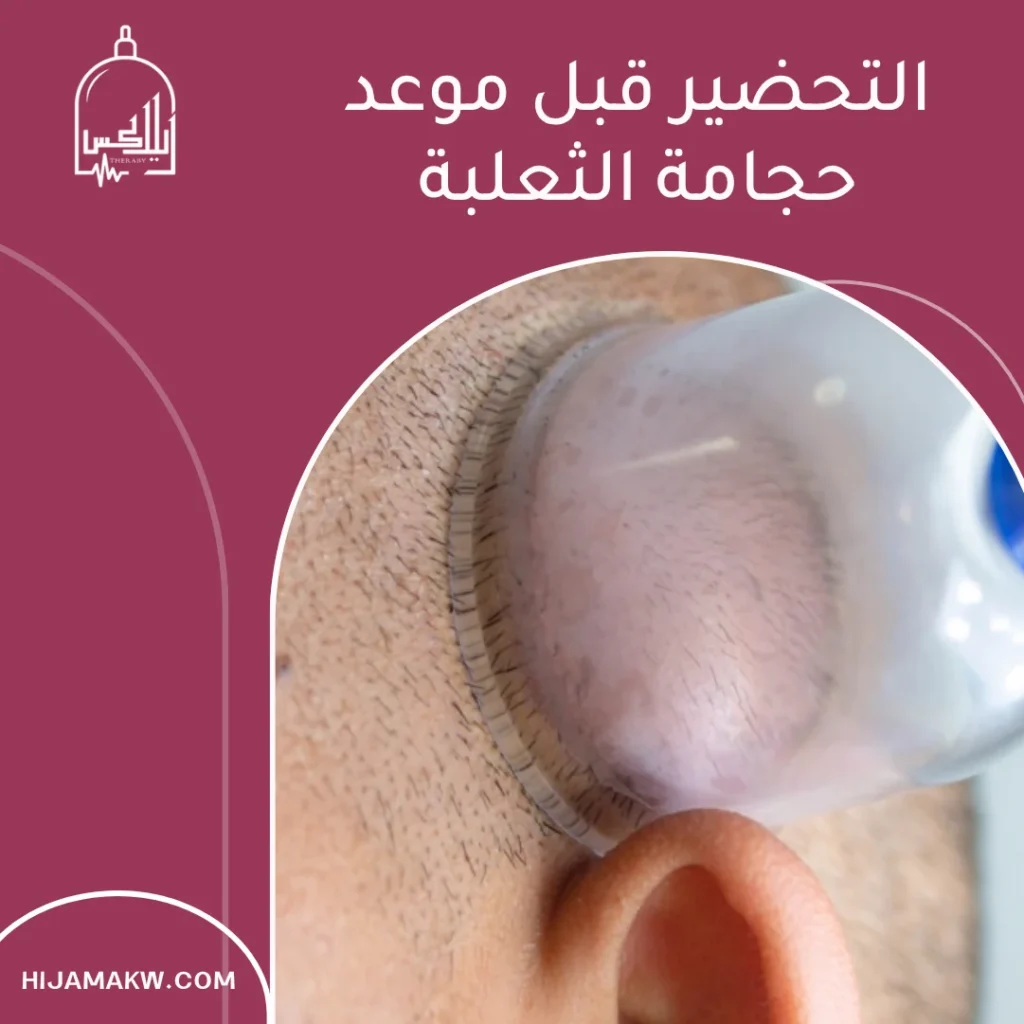 علاج الثعلبة بالحجامة: ما الذي نعرفه فعلاً؟ دليل عملي لسكان الكويت 50508666 علاج الثعلبة بالحجامة