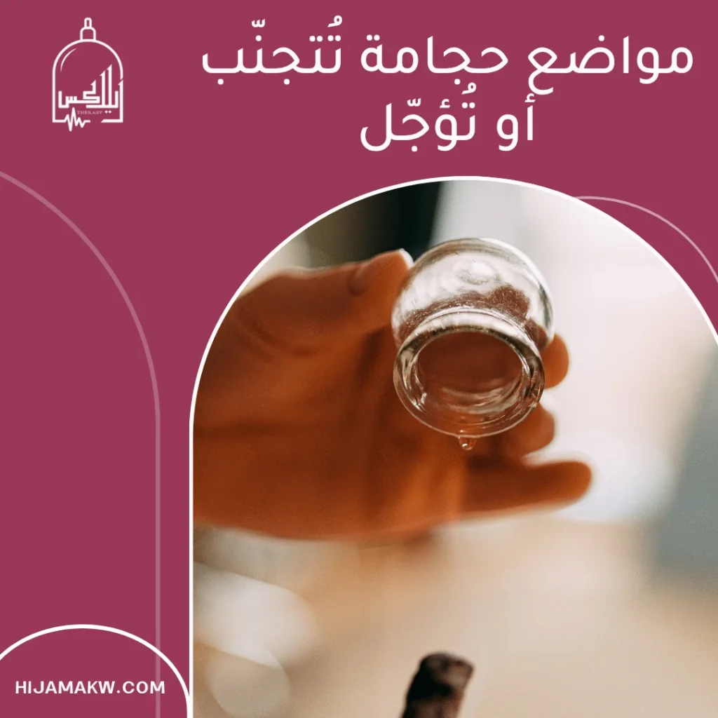 اماكن الحجامة الصحيحة في الكويت: خريطة عملية آمنة للنتائج الأفضل 50508666 3