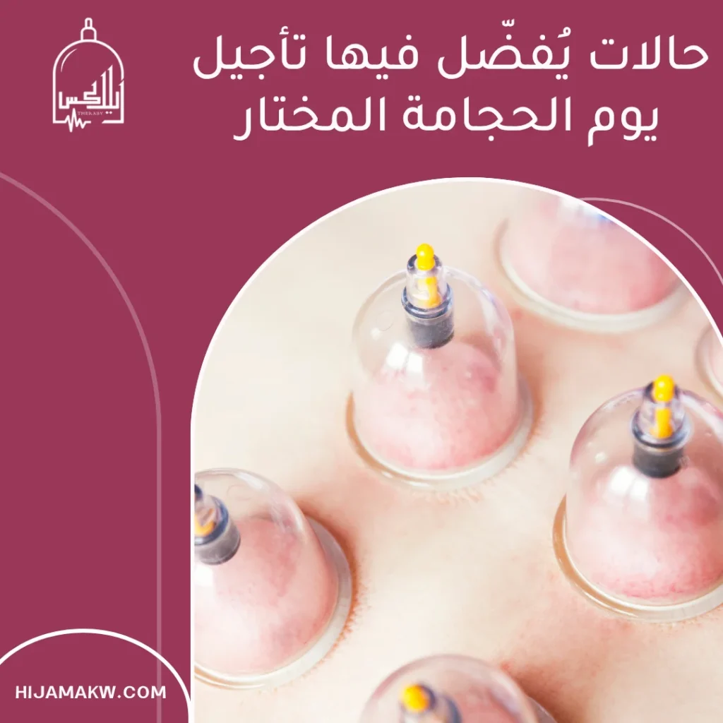ايام الحجامة في الكويت: متى أحجز جلستي لتحقيق أفضل نتيجة؟ 50508666 3