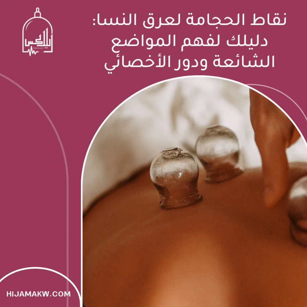 نقاط الحجامة لعرق النسا