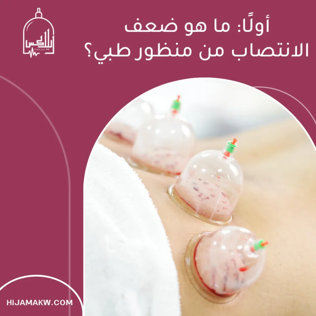 الحجامة التناسلية لعلاج ضعف الانتصاب: بين الواقع الطبي والتصورات الشائعة الحجامة التناسلية لعلاج ضعف الانتصاب