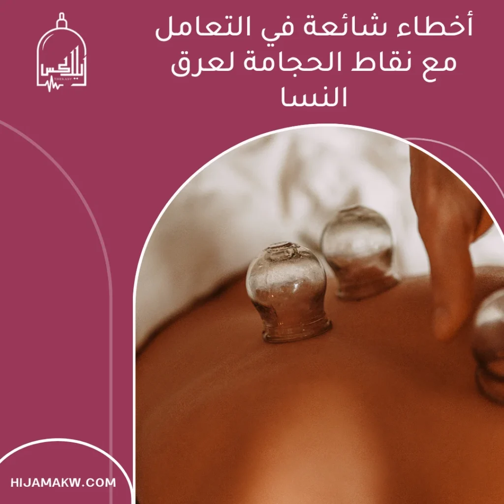 نقاط الحجامة لعرق النسا