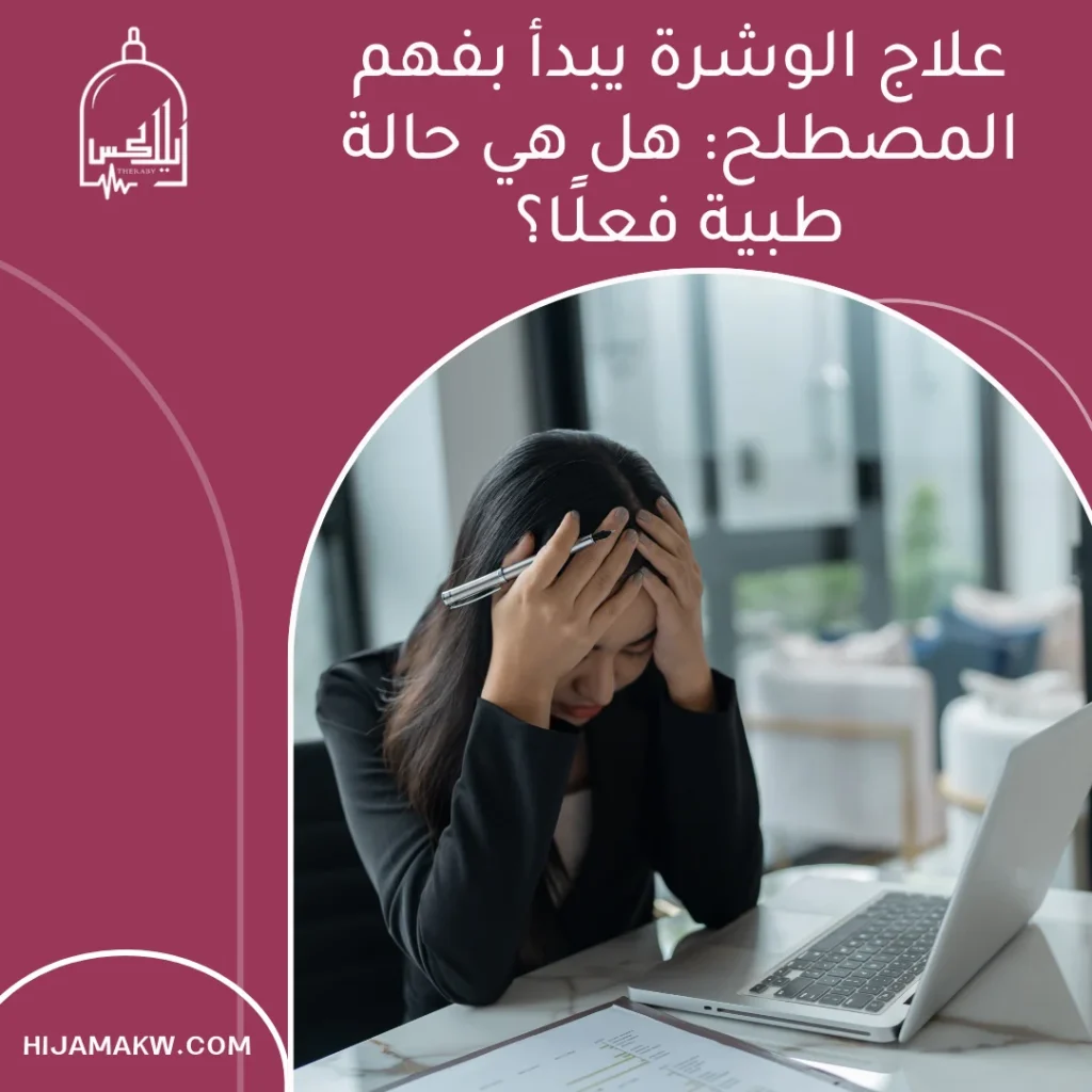 علاج الوشرة في الكويت