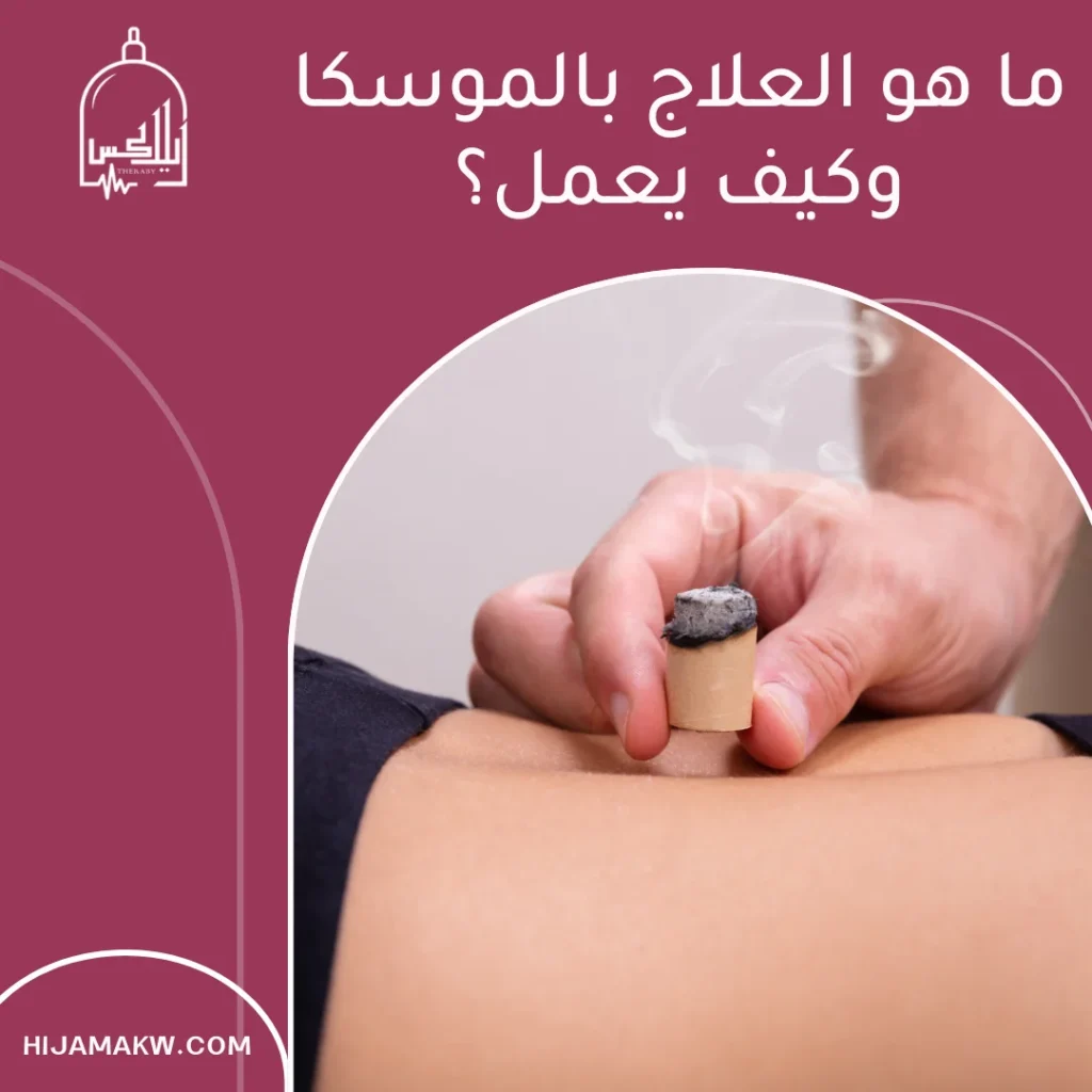 العلاج بالموسكا