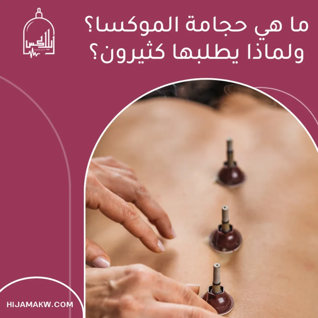 حجامة الموكسا
