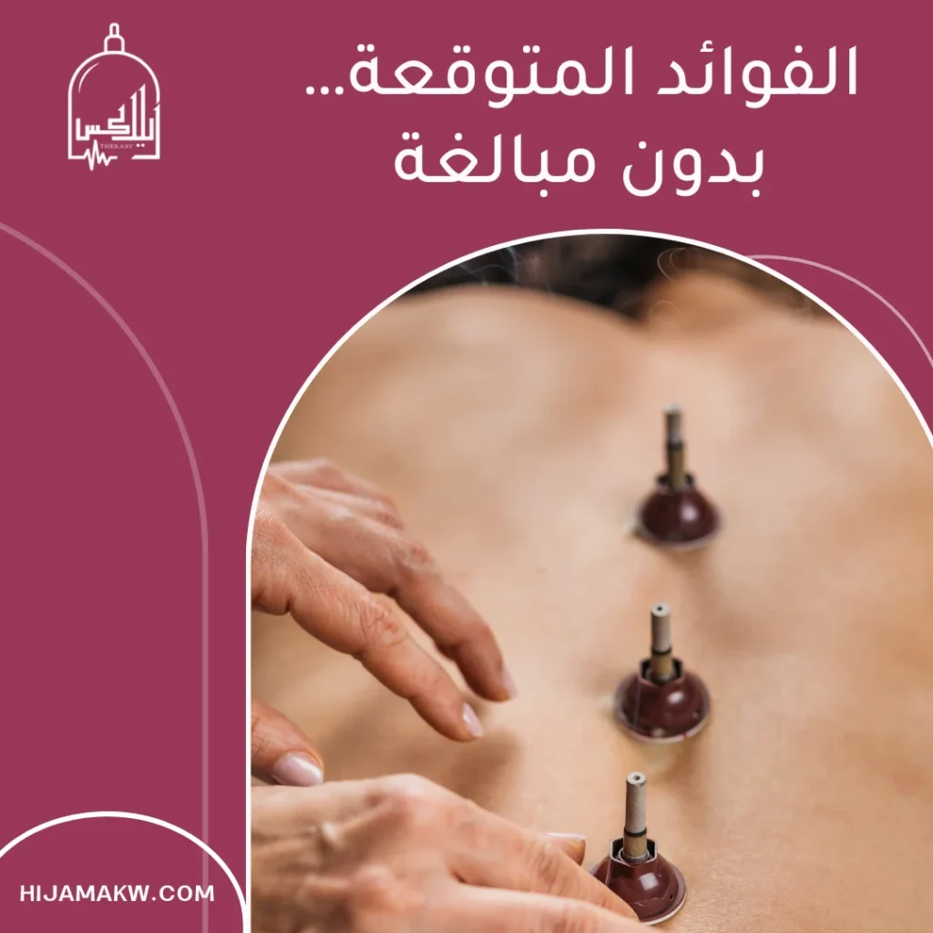 حجامة الموكسا