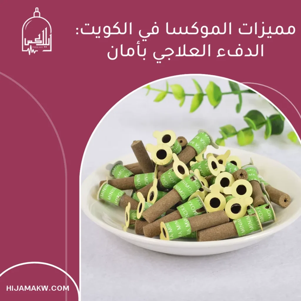 مميزات الموكسا