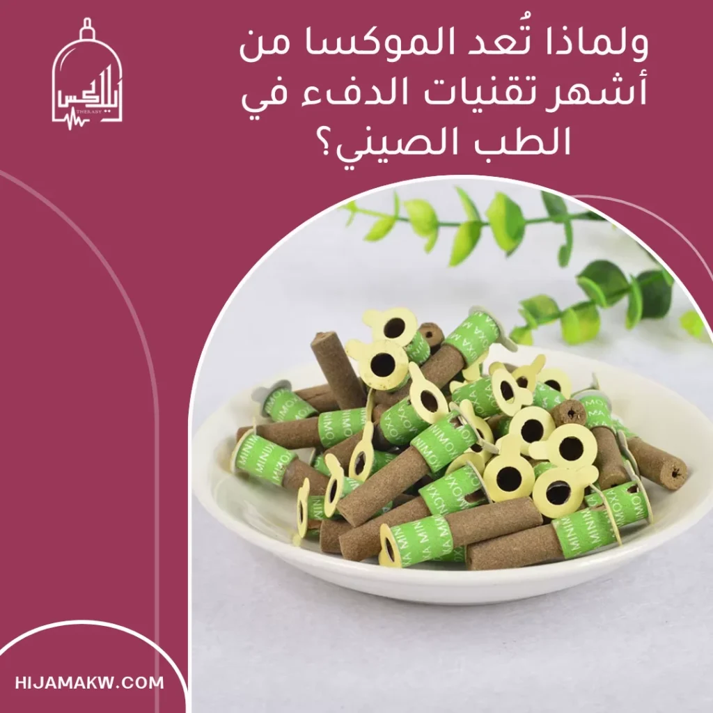 مميزات الموكسا