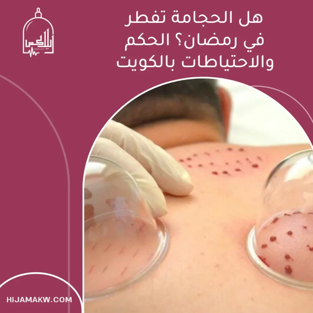 هل الحجامة تفطر في رمضان