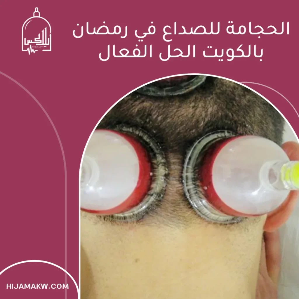 الحجامة للصداع في رمضان بالكويت