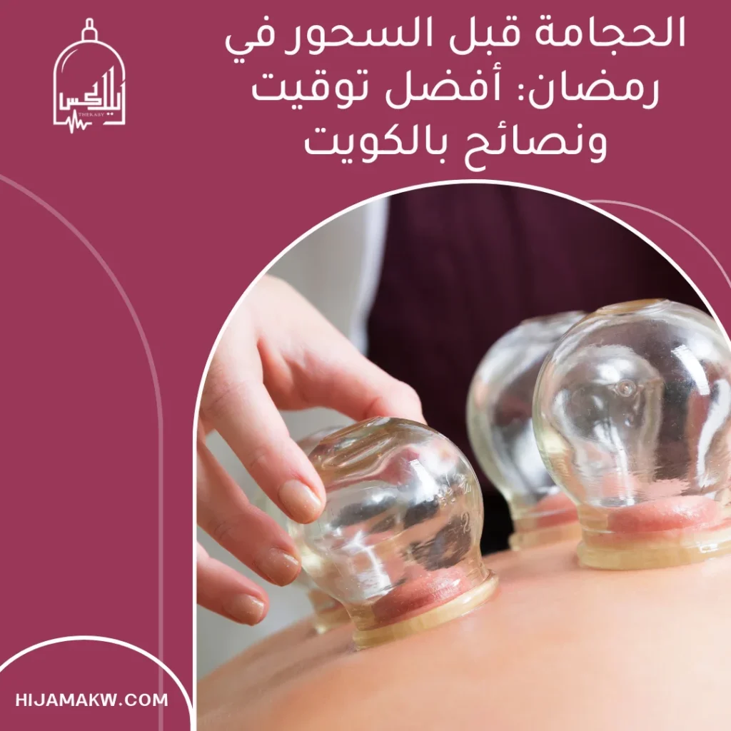 الحجامة قبل السحور في رمضان
