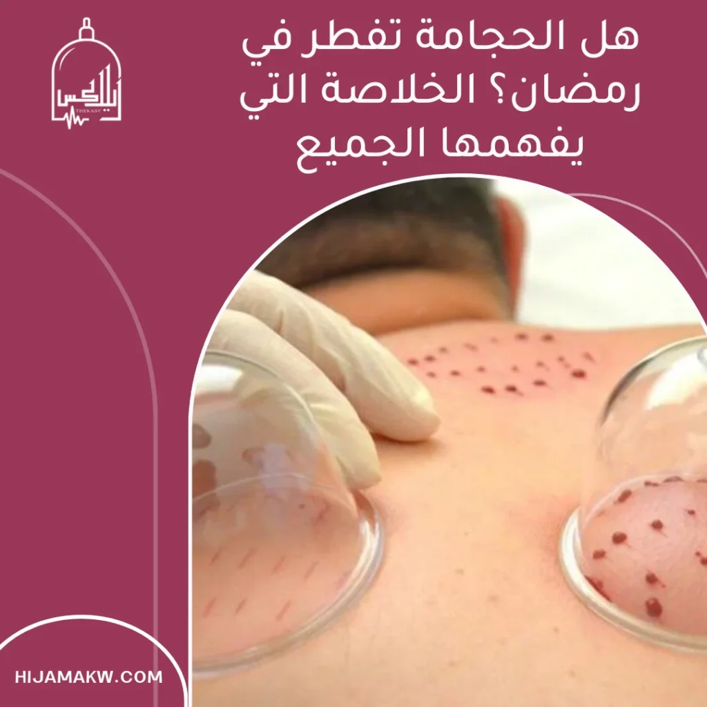 هل الحجامة تفطر في رمضان ؟ الحكم والاحتياطات بالكويت هل الحجامة تفطر في رمضان