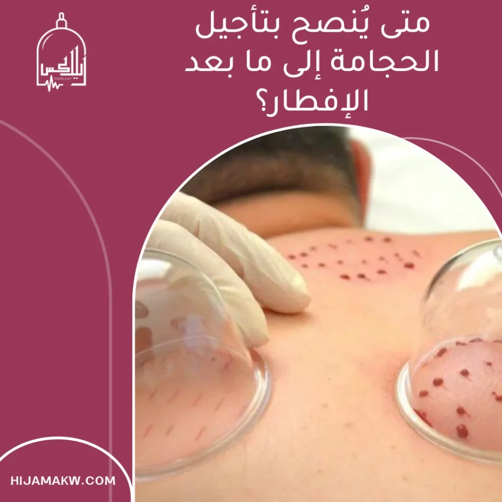 هل الحجامة تفطر في رمضان ؟ الحكم والاحتياطات بالكويت هل الحجامة تفطر في رمضان